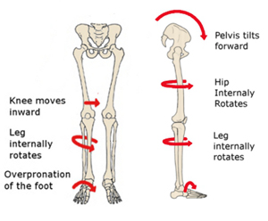 effects_of_pronation_on_skeleton